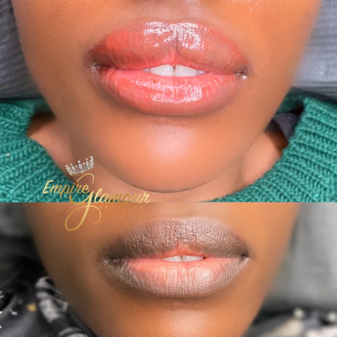 Candy Lips « Neutralisation »