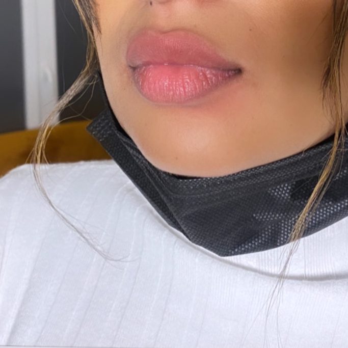 1 an après 2 passage !