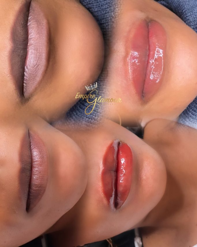 Candy Lips « Neutralisation » & retouche